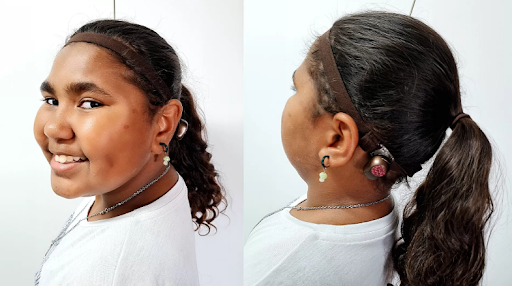 Teenage girl smiling to camera, wearing a bone conductor hearing device.